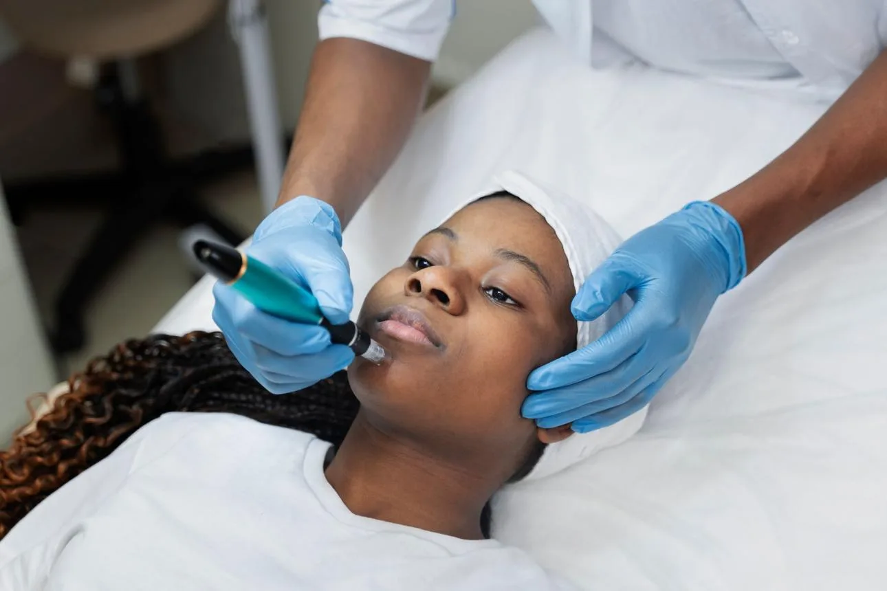 Microneedling Therapy